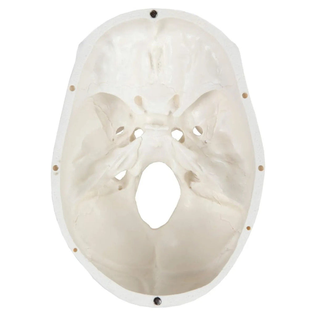 Top view of human skull model showing skull base with all foramina.