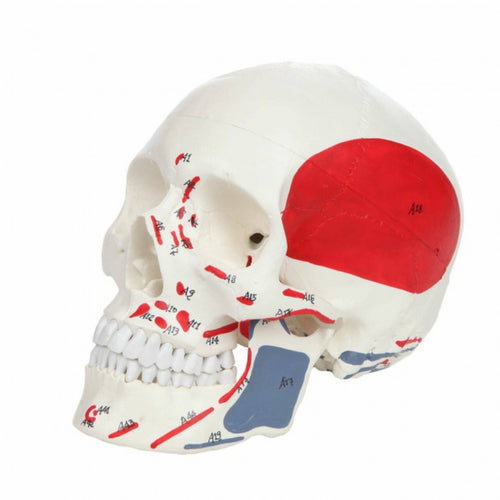 An anatomical model of a human skull showing labeled muscle attachments, with a large red area on the side and blue and red markings on a white background.